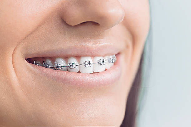 Best Wisdom Tooth Removal  in Bel Air North, MD